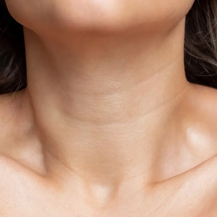 ตัวอย่างเส้นคอแนวขวาง (Horizontal Neck Lines)